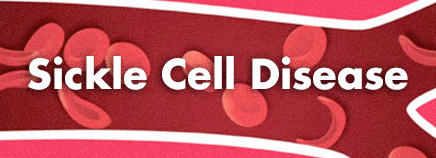 sickle cell information Beaumont TX, sickle cell Beaumont TX, sickle cell anemia Beaumont TX, anemia Beaumont Tx, sickle cell Southeast Texas, sickle cell Orange TX, sickle cell SETX, sickle cell Lumberton TX, sickle cell Silsbee TX